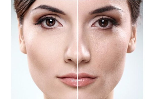 تفاوت پوست پاک شده صورت